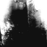 Benzalkonium I/II
