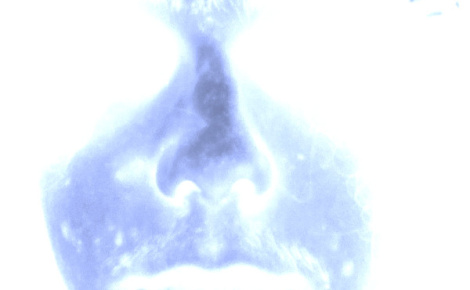 Interstate Highway Twenty-Five